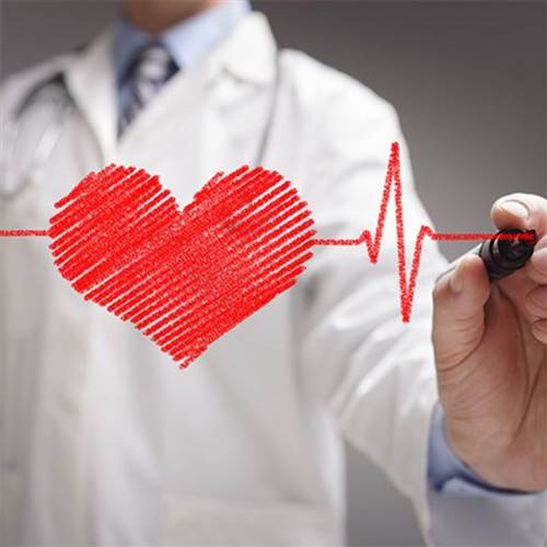Strokes and heart attacks